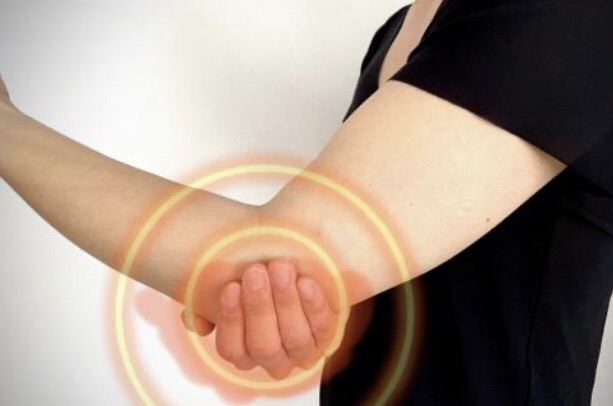 7月24日　　【物を持つと激痛】テニスをしていないのに「テニス肘」？八尾市の当院が教える原因とNG行動